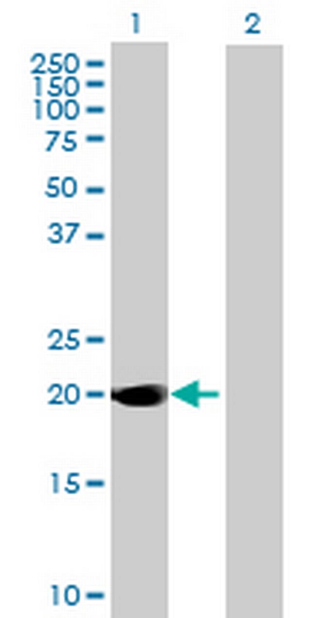 DUSP14 Antibody in Western Blot (WB)