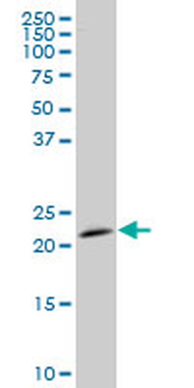 STMN2 Antibody in Western Blot (WB)