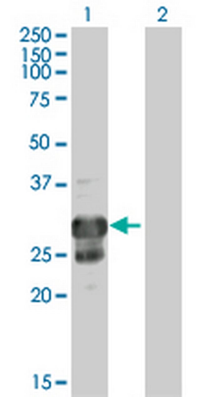 TPPP Antibody in Western Blot (WB)