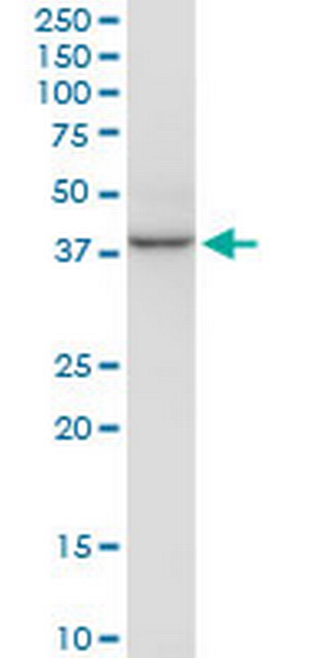 HSF2BP Antibody in Western Blot (WB)