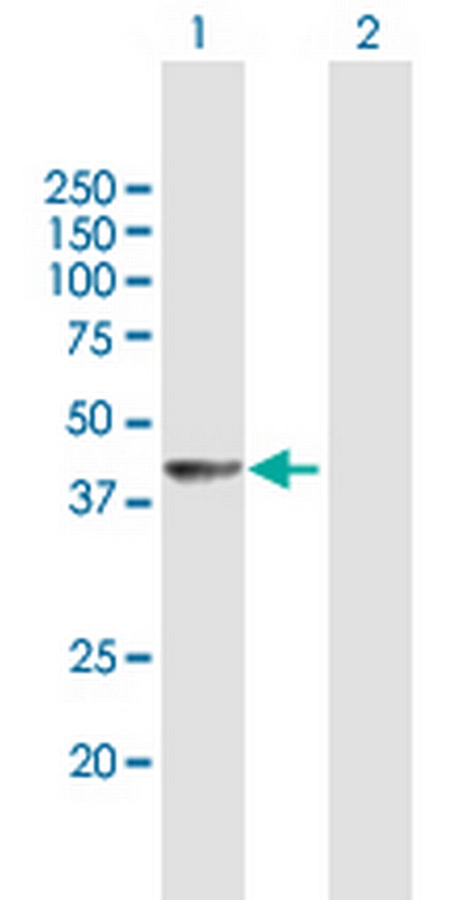 DNAJB4 Antibody in Western Blot (WB)