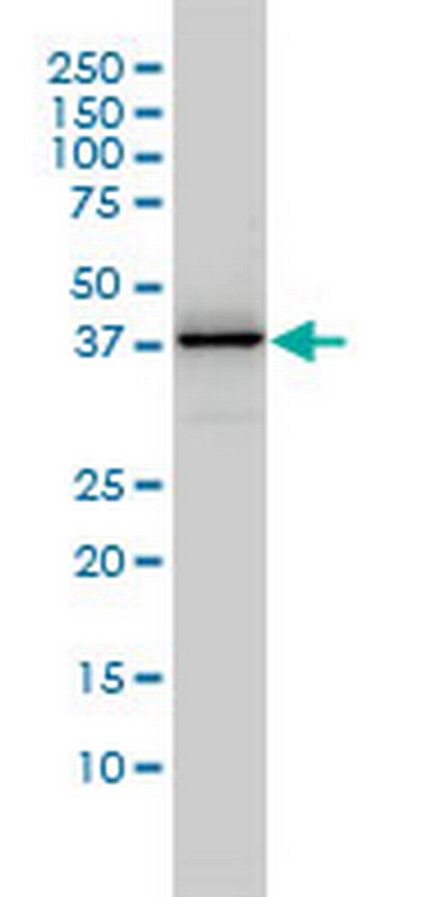 DNAJB4 Antibody in Western Blot (WB)
