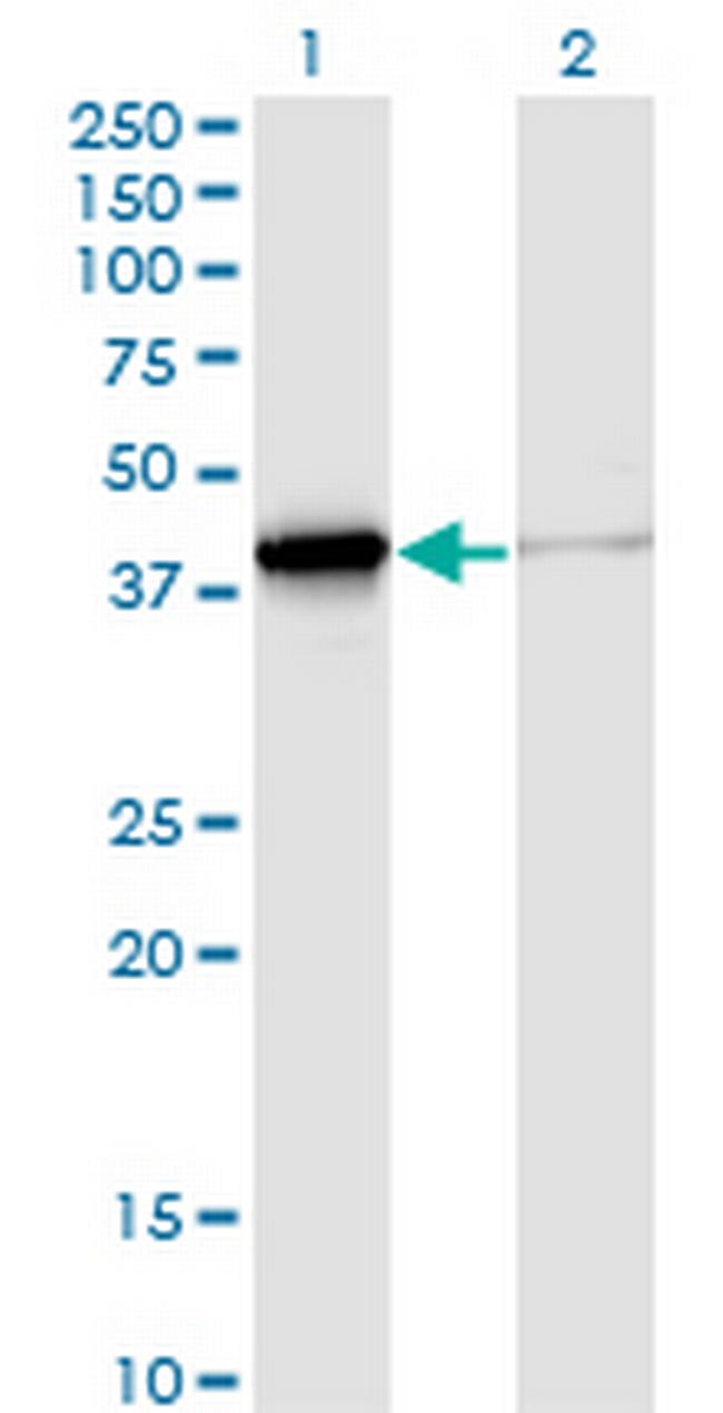 DNAJB4 Antibody in Western Blot (WB)