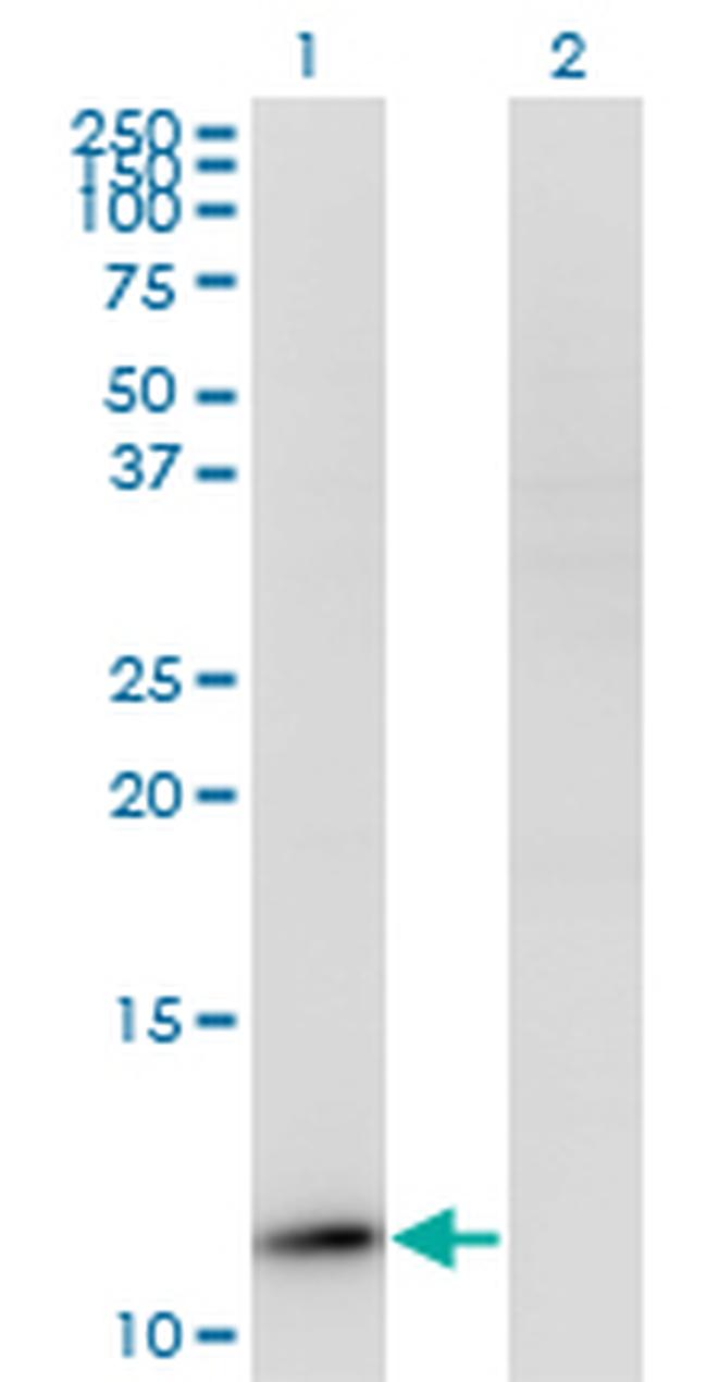 RPP14 Antibody in Western Blot (WB)