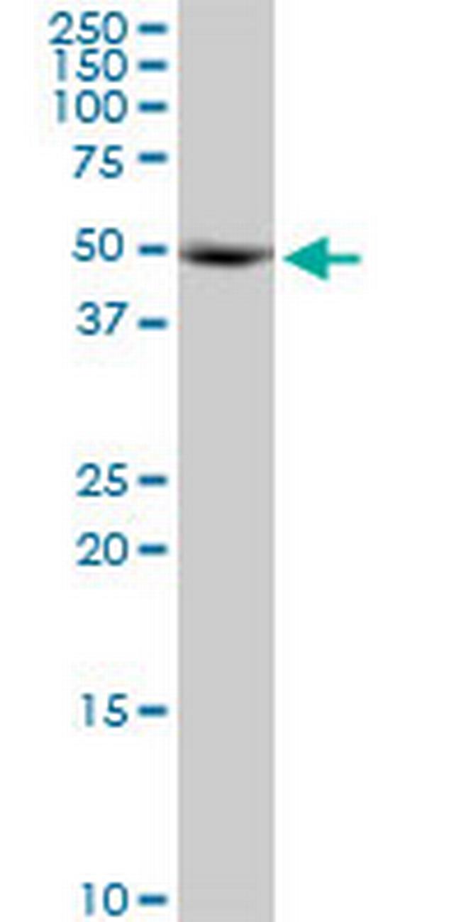 KRR1 Antibody in Western Blot (WB)