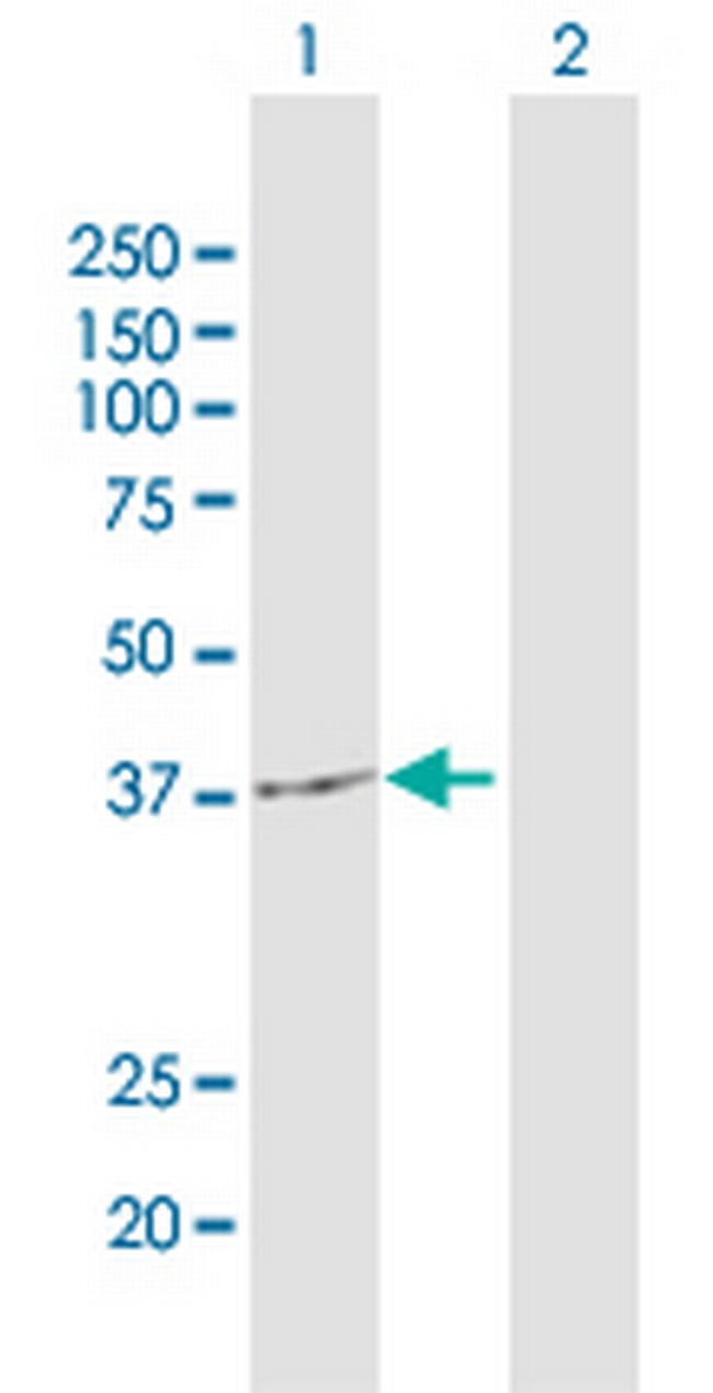 KATNA1 Antibody in Western Blot (WB)