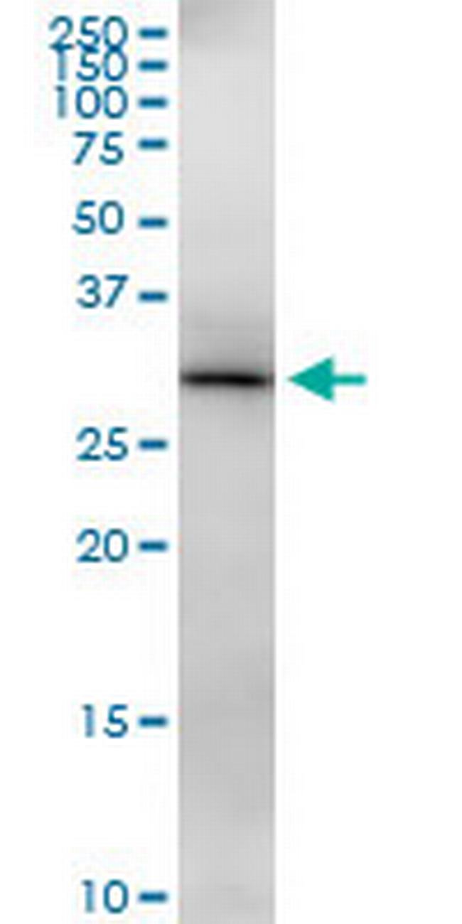 HIBADH Antibody in Western Blot (WB)