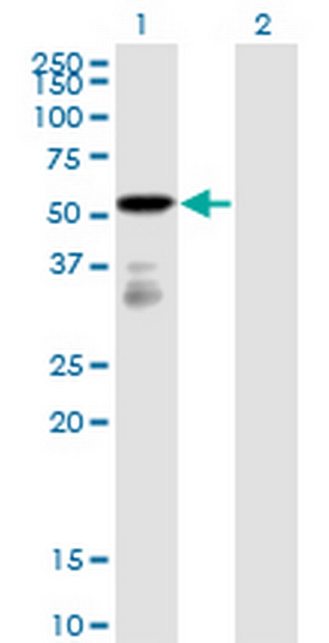 FGFR1OP Antibody in Western Blot (WB)