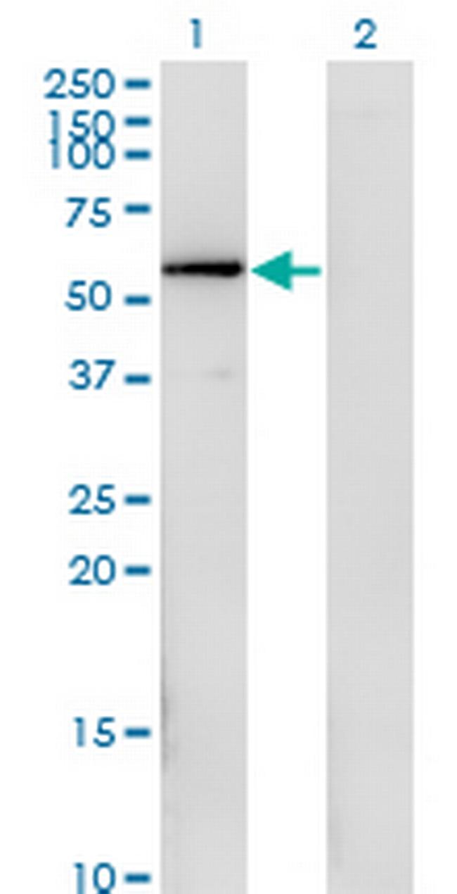 FGFR1OP Antibody in Western Blot (WB)