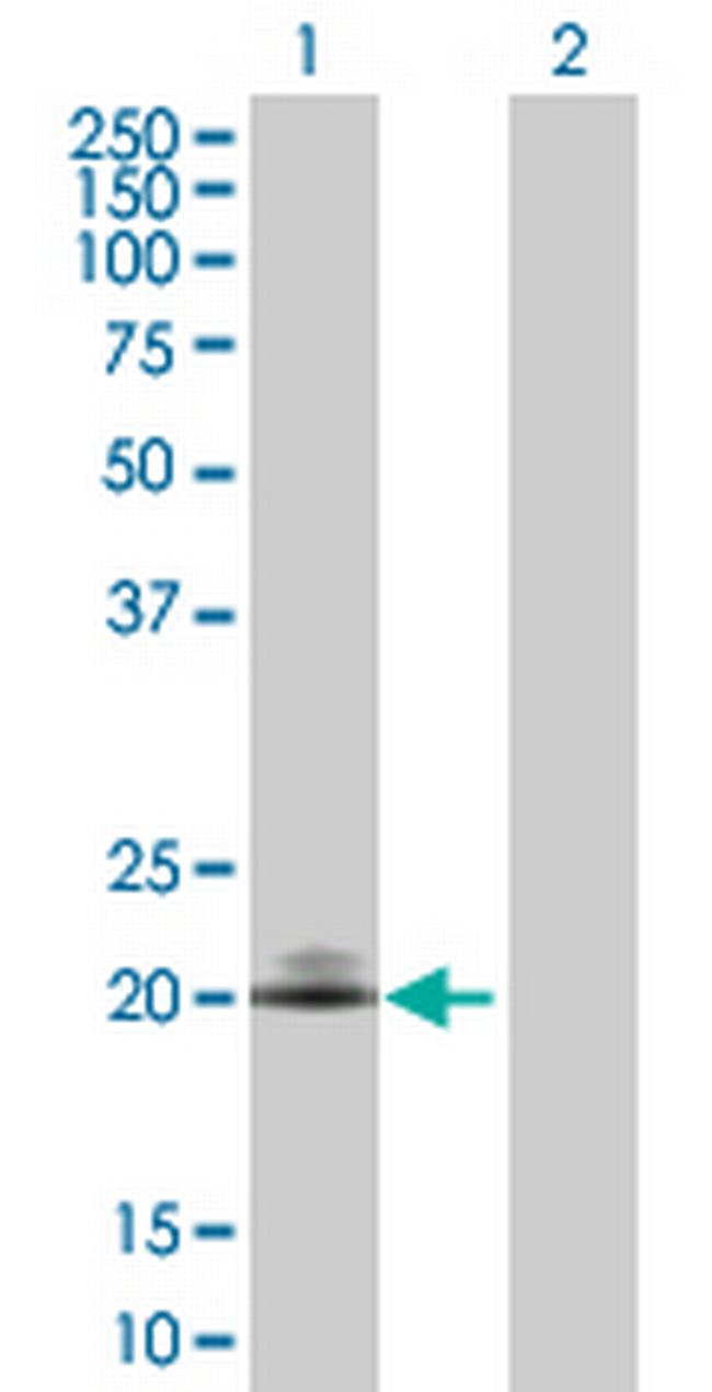 CD160 Antibody in Western Blot (WB)