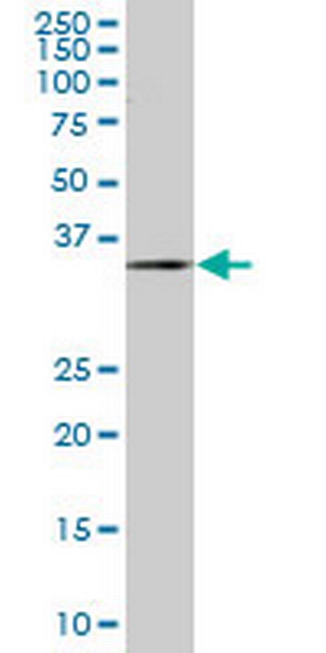 ZWINT Antibody in Western Blot (WB)