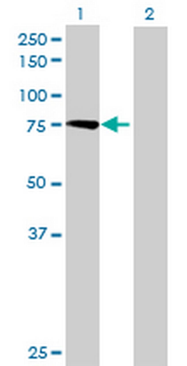 CAPN11 Antibody in Western Blot (WB)