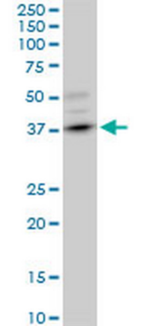 DMC1 Antibody in Western Blot (WB)