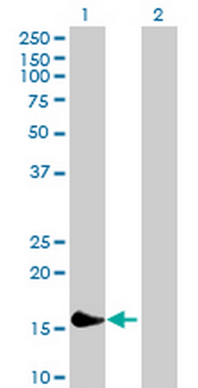 HRASLS3 Antibody in Western Blot (WB)