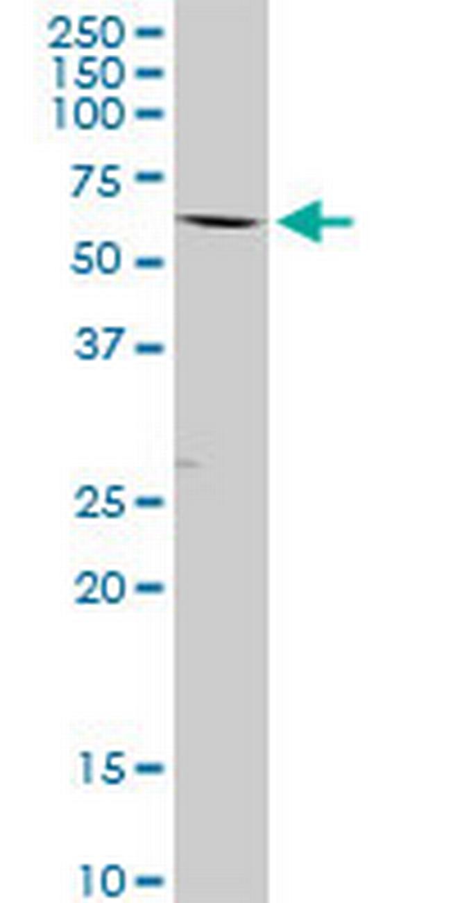 GLMN Antibody in Western Blot (WB)