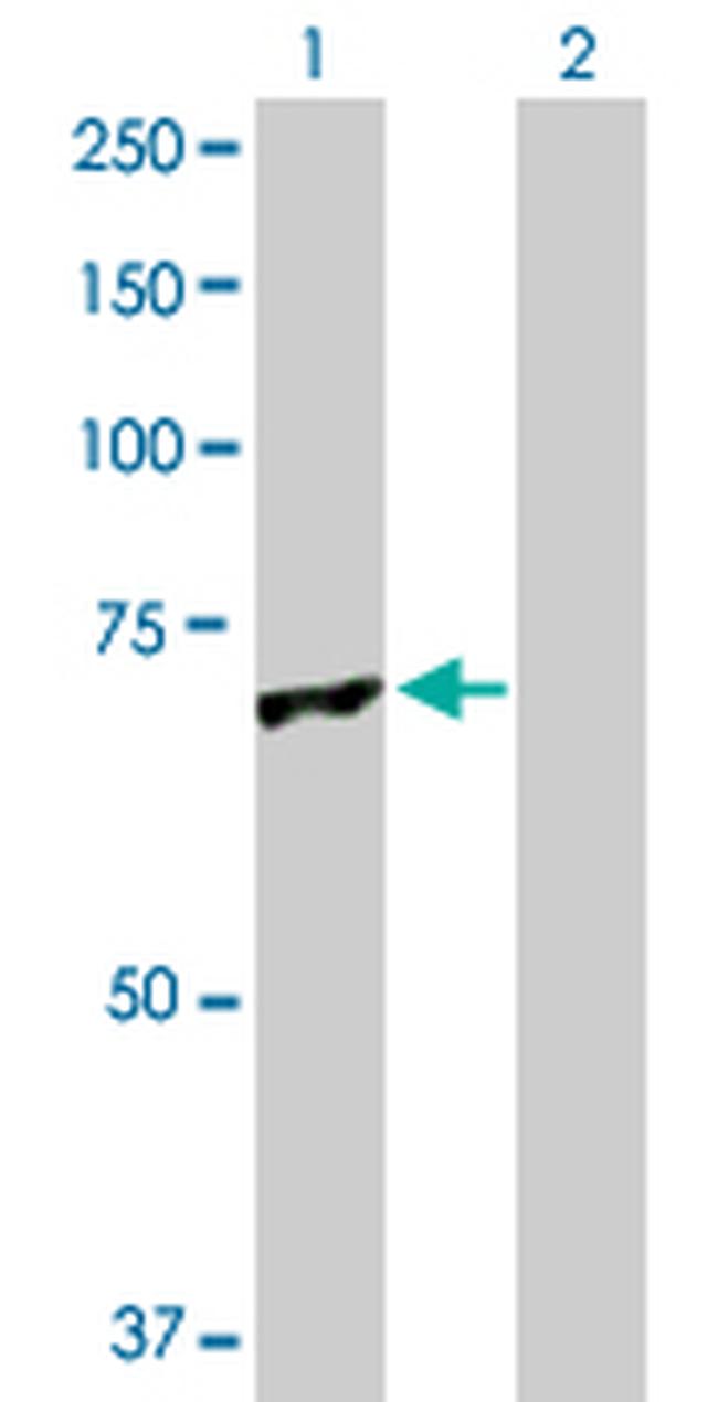 GLMN Antibody in Western Blot (WB)