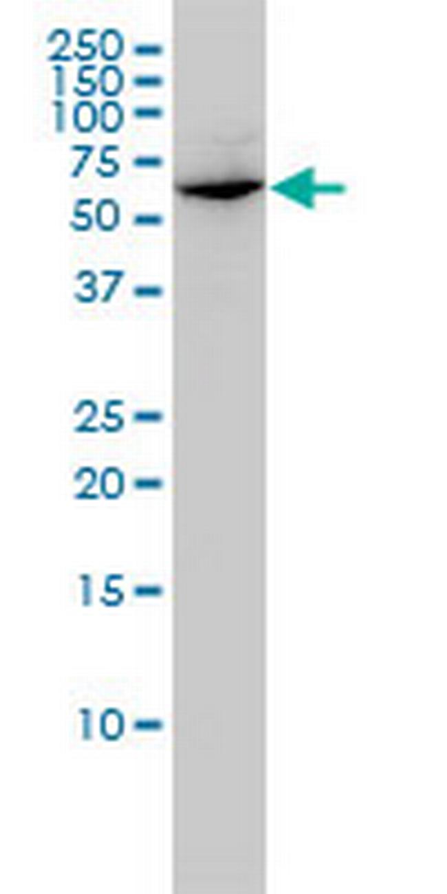 GLMN Antibody in Western Blot (WB)