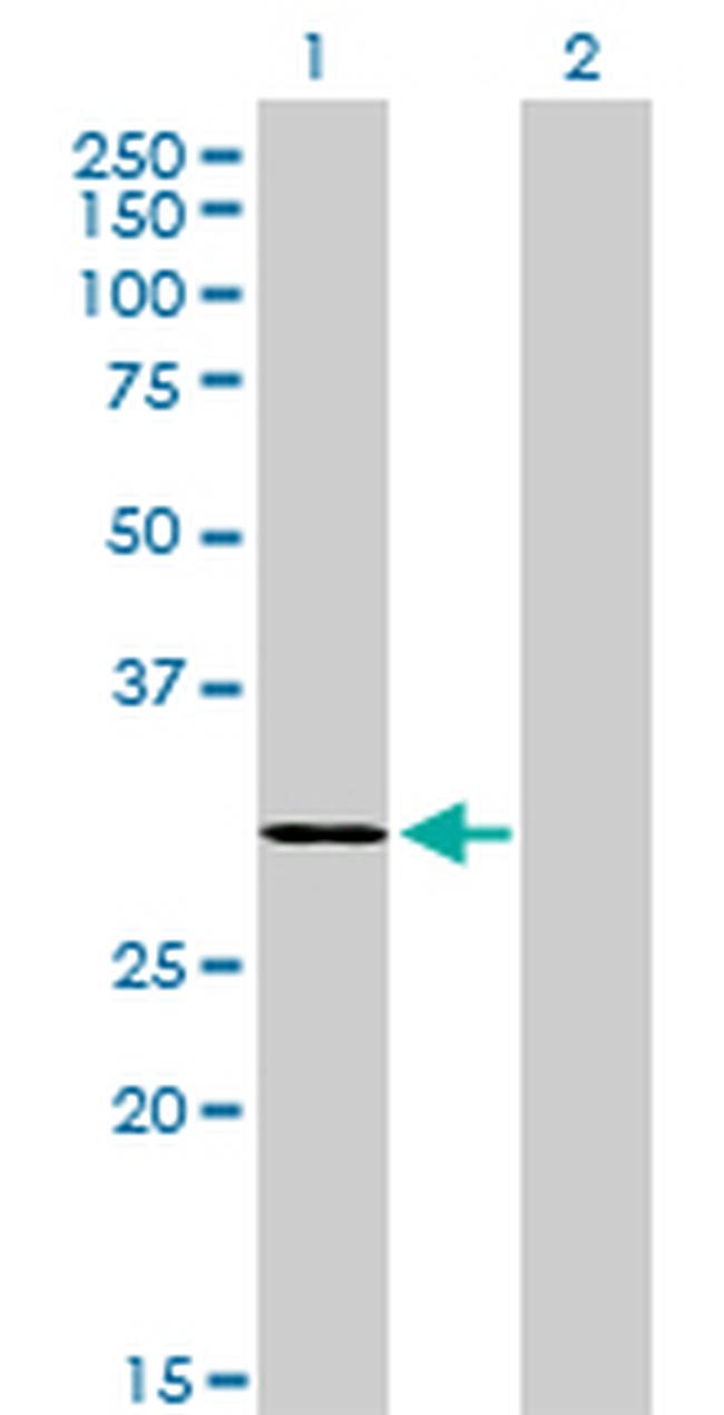 LDB3 Antibody in Western Blot (WB)