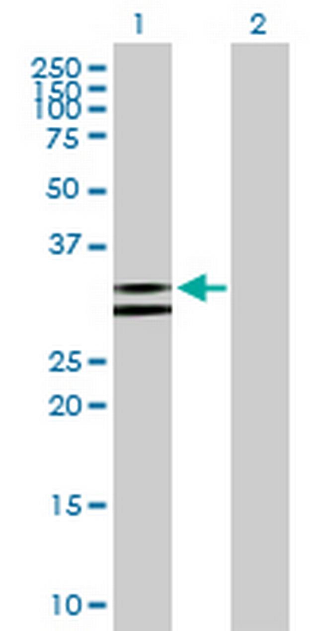 NUDT6 Antibody in Western Blot (WB)