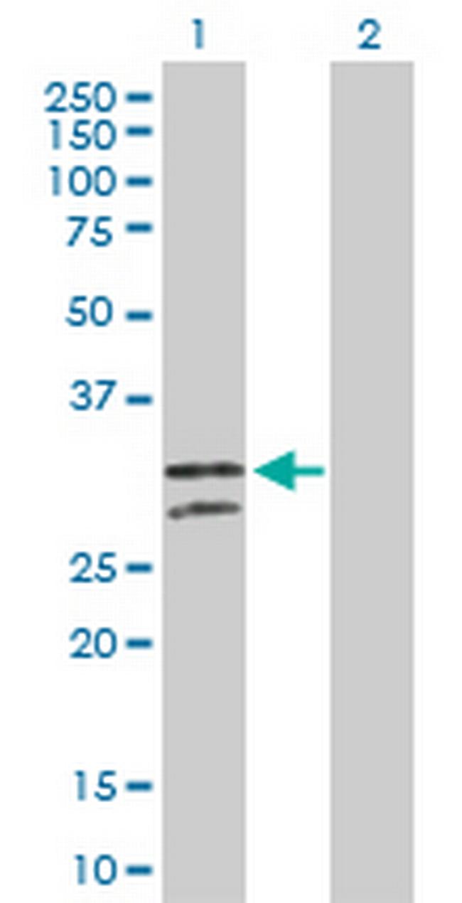 NUDT6 Antibody in Western Blot (WB)