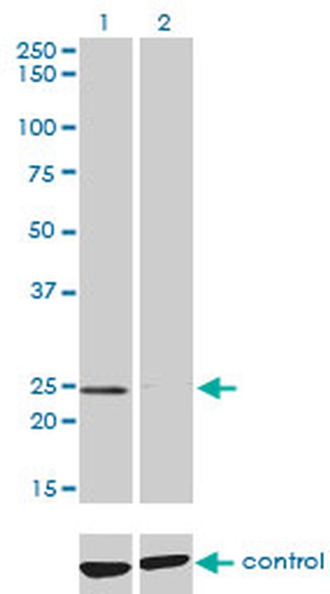 NUDT5 Antibody in Western Blot (WB)