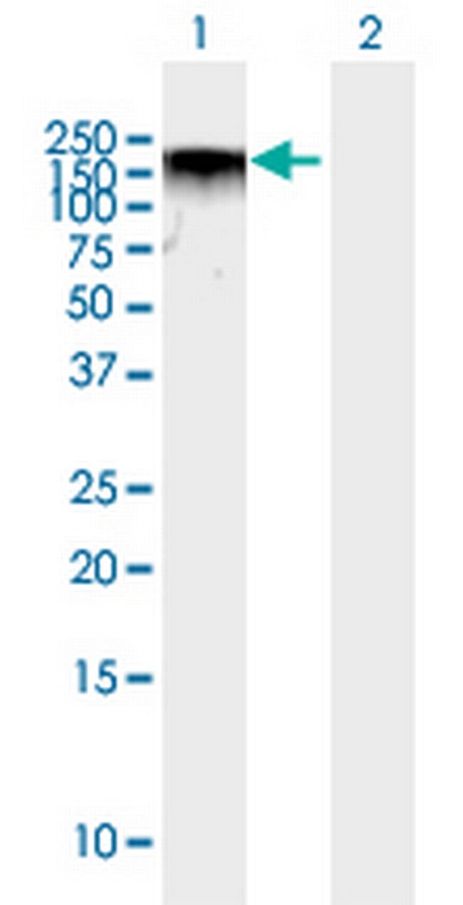 BAZ2A Antibody in Western Blot (WB)