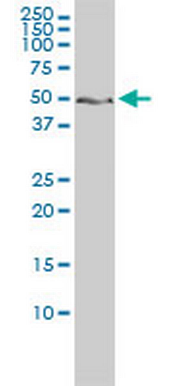 ZNF277 Antibody in Western Blot (WB)