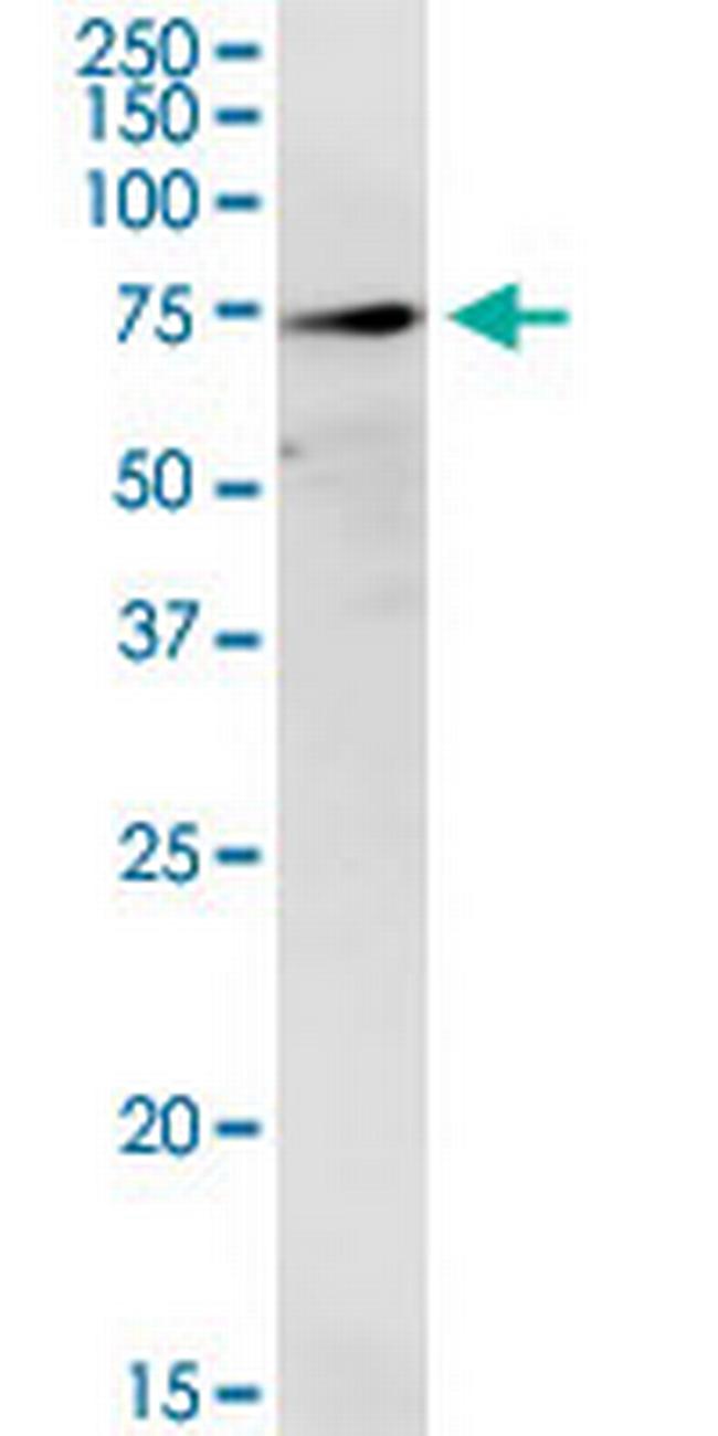 TREH Antibody in Western Blot (WB)