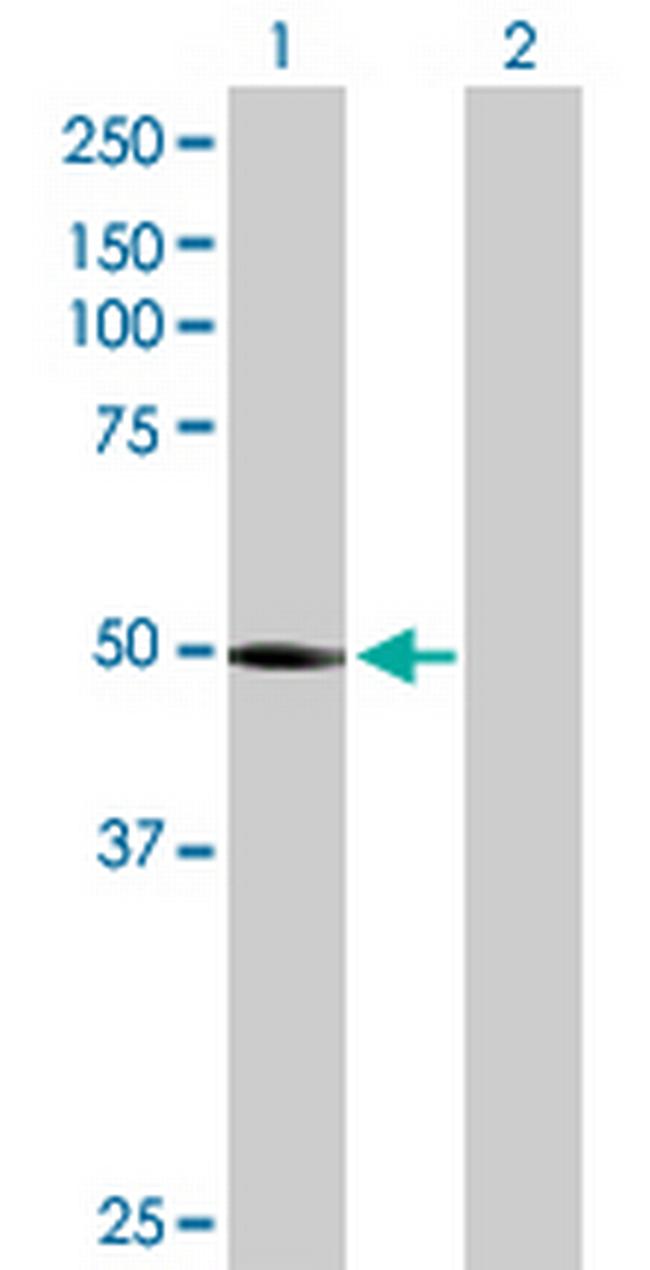 PTENP1 Antibody in Western Blot (WB)