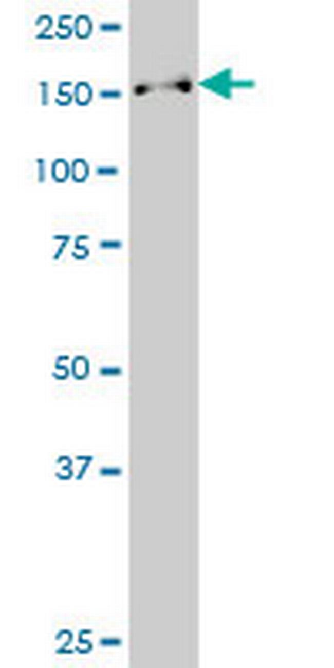 SUPT16H Antibody in Western Blot (WB)