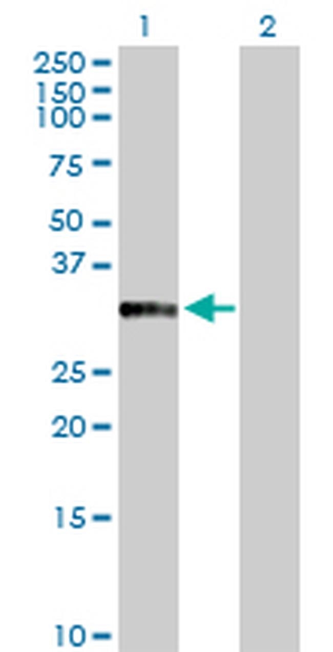 ANXA10 Antibody in Western Blot (WB)