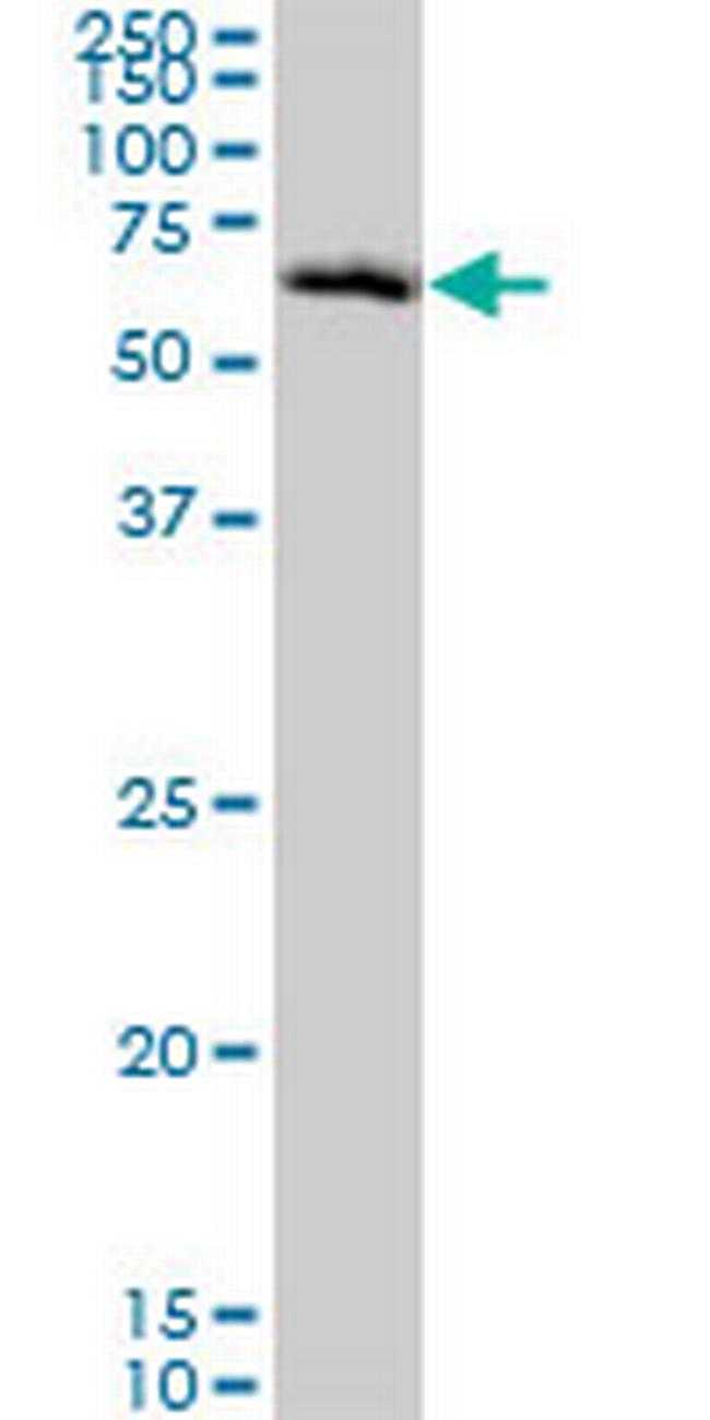 CHEK2 Antibody in Western Blot (WB)