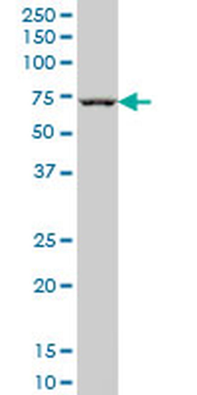 CHEK2 Antibody in Western Blot (WB)