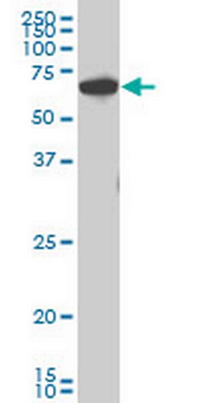 CHEK2 Antibody in Western Blot (WB)