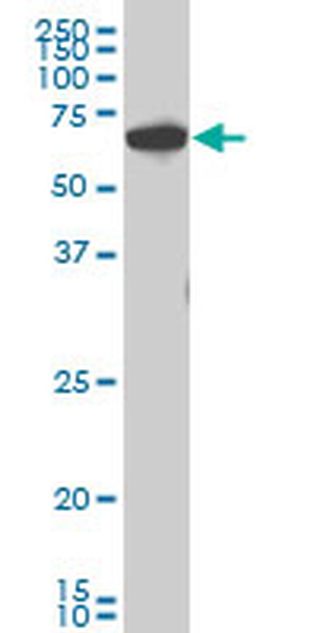 CHEK2 Antibody in Western Blot (WB)