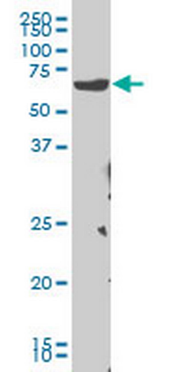 CHEK2 Antibody in Western Blot (WB)