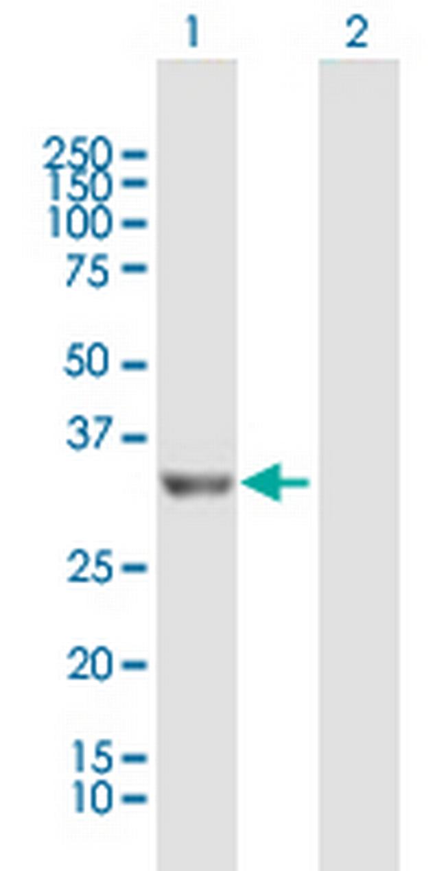 PROSC Antibody in Western Blot (WB)