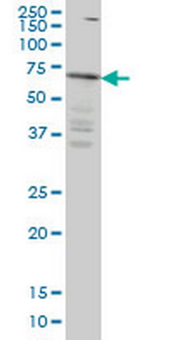 IRAK3 Antibody in Western Blot (WB)