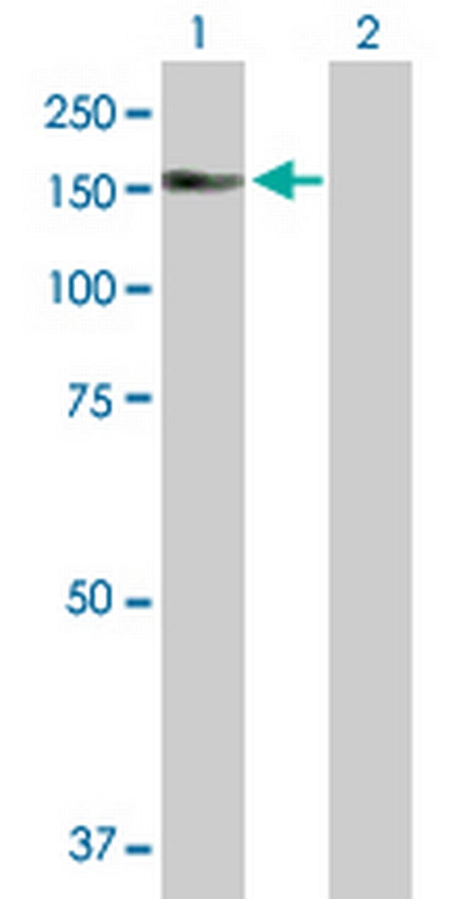 AKAP13 Antibody in Western Blot (WB)