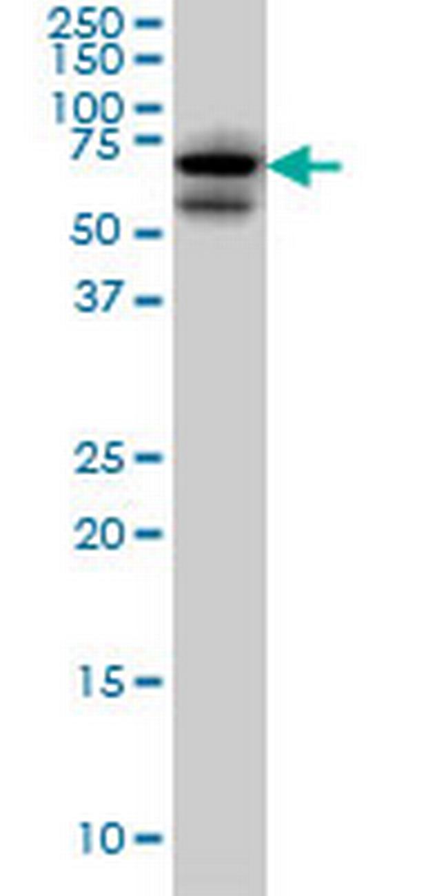 AKAP10 Antibody in Western Blot (WB)
