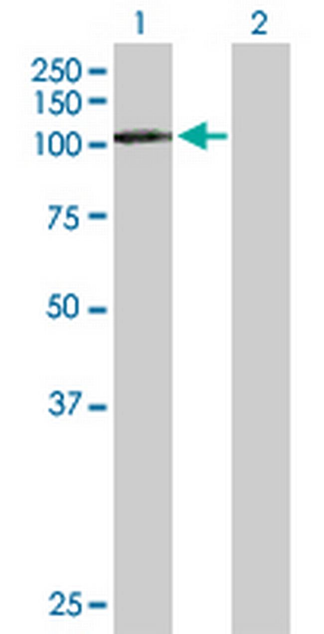 DDX20 Antibody in Western Blot (WB)