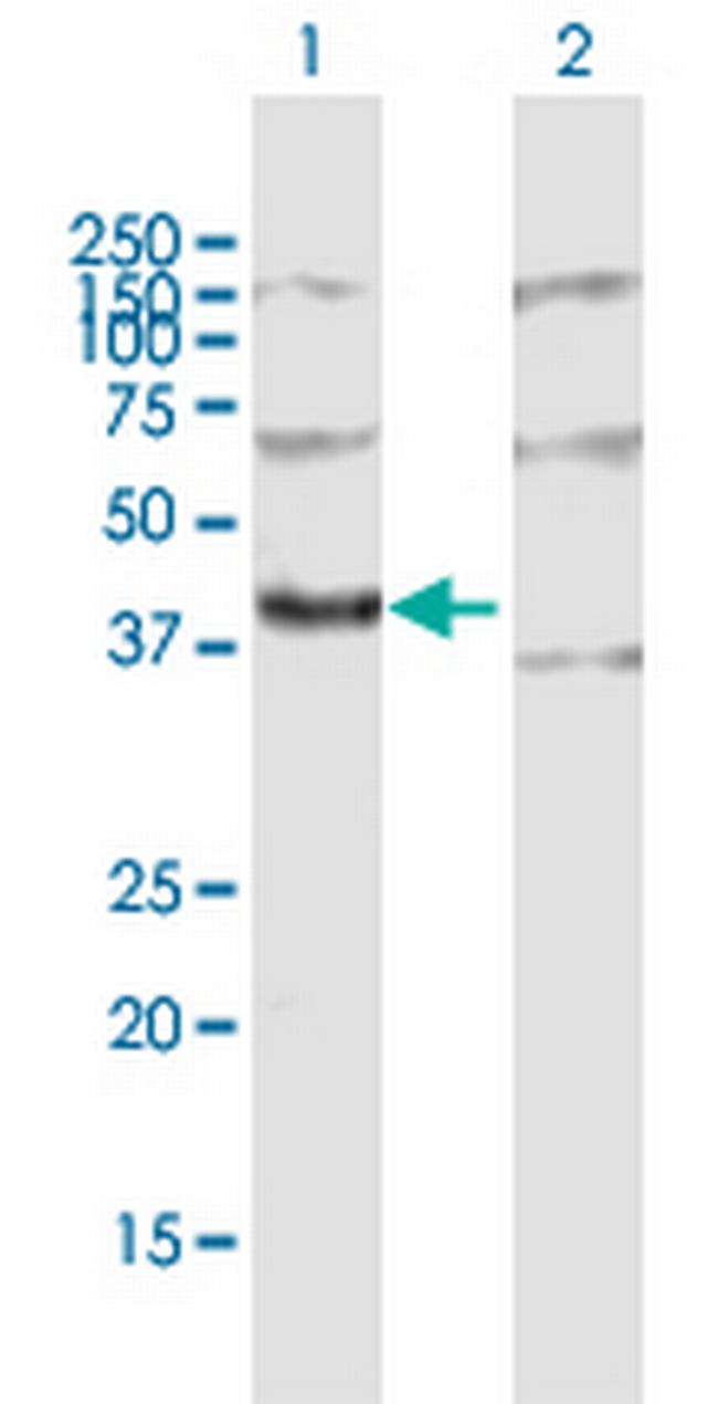 MRPL3 Antibody in Western Blot (WB)