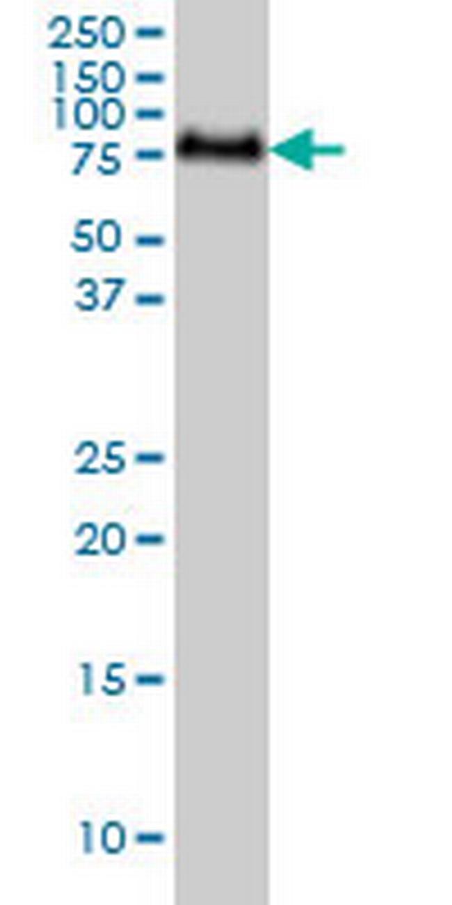 GALNT6 Antibody in Western Blot (WB)