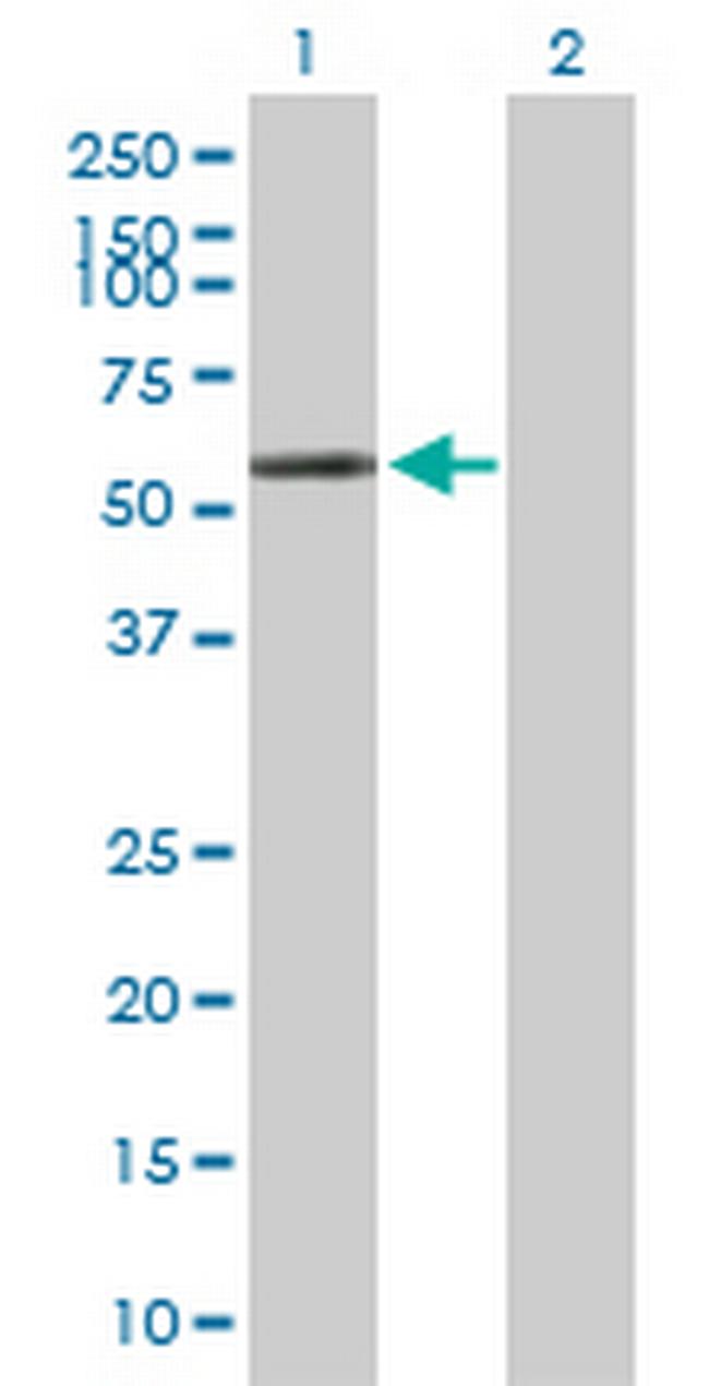 POLG2 Antibody in Western Blot (WB)