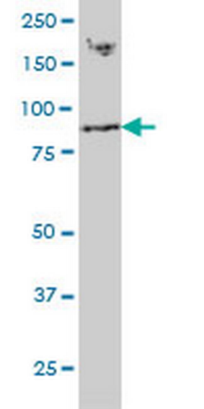 RNF139 Antibody in Western Blot (WB)