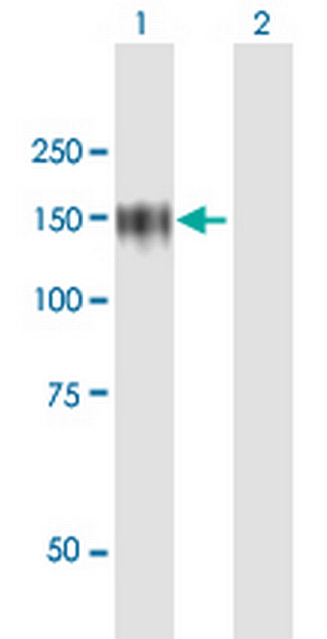 ZHX1 Antibody in Western Blot (WB)