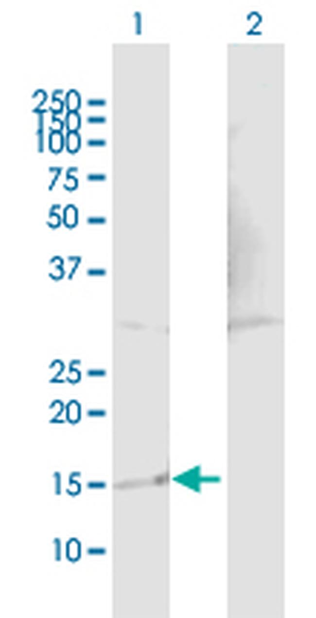 TP53TG1 Antibody in Western Blot (WB)
