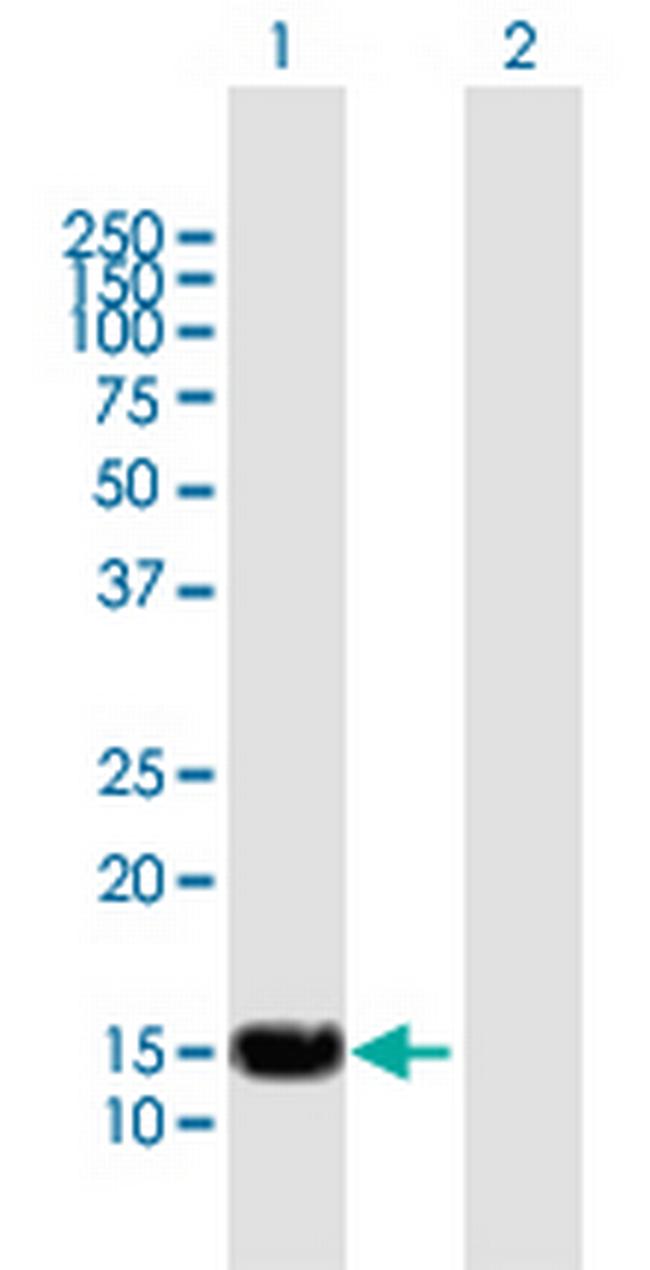 SP140 Antibody in Western Blot (WB)