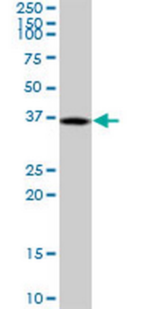 DUSP12 Antibody in Western Blot (WB)