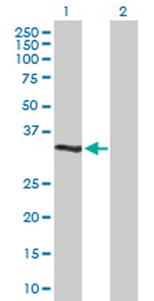 DUSP12 Antibody in Western Blot (WB)